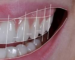 Imagem de Planejamento digital do sorriso em odontologia
