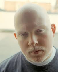 Ali grande Albinism Brother Ali foto compartilhado por Leonardo3 | Português ... - ali-large-albinism-887840551
