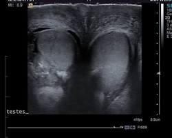 Image of Ultrasound of the testicles