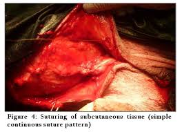 Image result for simple continuous suture pattern