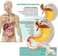 Douleur oesophage