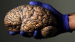  Scientists develop a brain implant that improves memory and recall capacity