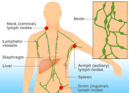 Hodgkin Disease (Penyakit Hodgkin)