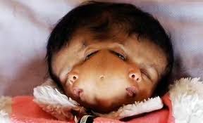 Image result for depleted+uranium+babies