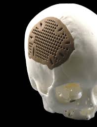 NEW! PEEK-OPTIMA™ AM FILAMENT