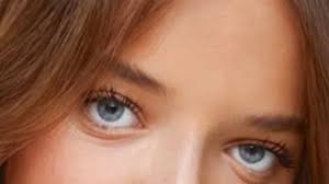 Aos 16 anos, Rafaella Justus faz a segunda rinoplastia de sua vida e mostra o resultado