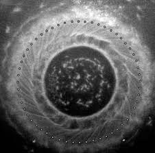 Image result for cartwheel galaxy