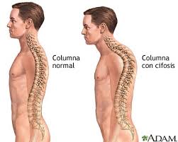 Resultado de imagen de espalda normal