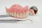 Protesi mobile - Cliniche Dentali Giovanni Bona