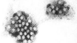 Norovirus Outbreak Hits Luxury Oceania Insignia Cruise