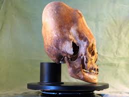 Résultat de recherche d'images pour "elongated skulls"