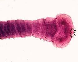 Image of Taenia solium (pork tapeworm)