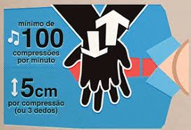 Resultado de imagem para MASSAGEM CARDÍACA