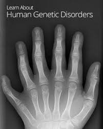 Image result for human genetic disorders