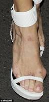 Image result for ugly women's feet