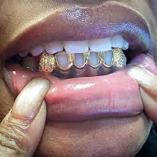 Image result for teeth grillz