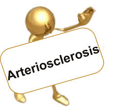Resultado de imagen de Arteriosclerosis