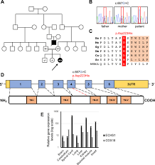 A Biallelic COX18 Variant Leading to Neonatal Encephalo-Cardio Disorder: Isolated Complex IV Deficiency - 1