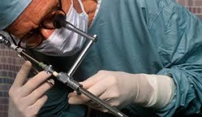 Laparoscopic Choledocolithotomy