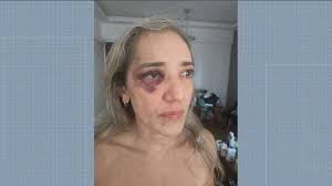 Passageira denuncia agressão de motociclista de aplicativo após desistir da corrida por causa de capacete