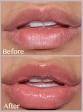 Lip plumper with collagen