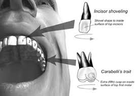 Résultat de recherche d'images pour "shovel shaped incisors"