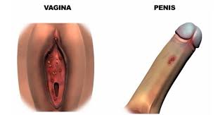 Znalezione obrazy dla zapytania hpv