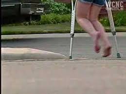 Résultat de recherche d'images pour "copperhead bites"