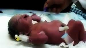 Image result for depleted+uranium+babies