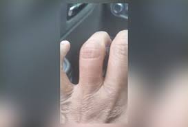 'Era latão': ladrão ataca motorista de táxi a dentada para levar aliança, próximo de batalhão da PM