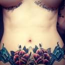 Can You Tattoo Over Scars?