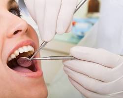 What are the types of Dental Treatment?