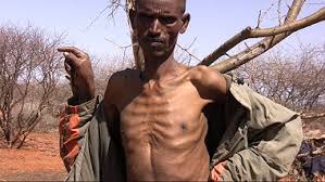 Image result for starving people