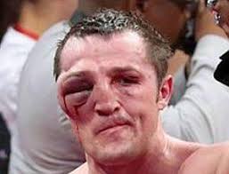 <b>denis</b>-<b>lebedev</b>-eye.png - denis-lebedev-eye