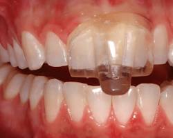 Image of NTItss device in use