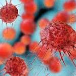  Immunotherapy transforms lung cancer, the biggest cancer killer