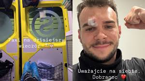 Albert Kosiński miał WYPADEK. "Uważajcie na siebie"