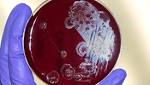  Antibiotics Didn't Cure Their Infections. Fecal Bacteria Did.