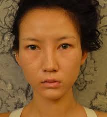 ... อีกทั้งเธอยังไม่สนใจผู้ชายที่มีทัศนคติที่ติดลบเกี่ยวกับผู้หญิงที่ทำศัลยกรรมอีกด้วย. Chen Yi Man ก่อนทำศัลยกรรม. ช่วงเวลาที่ทำศัลยกรรม - 755299-img-1395801644-2