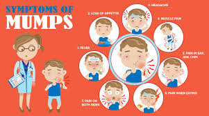 Image result for Mumps