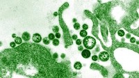 Ghana is Lassa Fever free - GHS