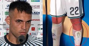 Lisandro Martínez Reveals the Secret 'Palo Santo' Ritual That Powers Argentina’s World Cup Luck: Inside La Scaloneta’s Esoteric Bunker