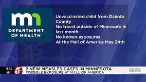 Measles Outbreak in Minnesota: Mall of America Exposure