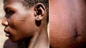 Image result for scars