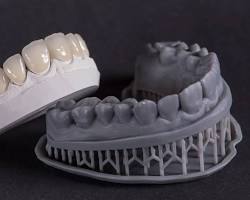 Image of 3D printed dental model