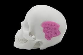 Scientists Can Now 3D Print Glass To Help Bones Grow Back ...