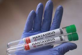 Hantavírus no Brasil: quais os riscos e como prevenir a doença?