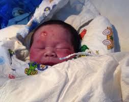 Miraculous survivor: Baby Xiao Zhao is being cared for in hospital in Fujian Province, China, after his mother was killed when she was hit by a truck on her ... - article-2585361-1C70156300000578-629_634x501