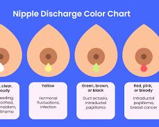 Nipple Discharge