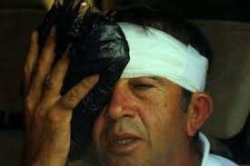 Maç sırasında TGF Başkanı Ahmet Ağaoğlu&#39;nun vurduğu top, izleyicilerden birisinin kafasına geldi. Eski devlet bakanı Fikret Ünlü, iş adamları Mustafa Koç ve ... - 120392-ahmet-agaoglu-hedefi-sasirdi-5078322e586ef